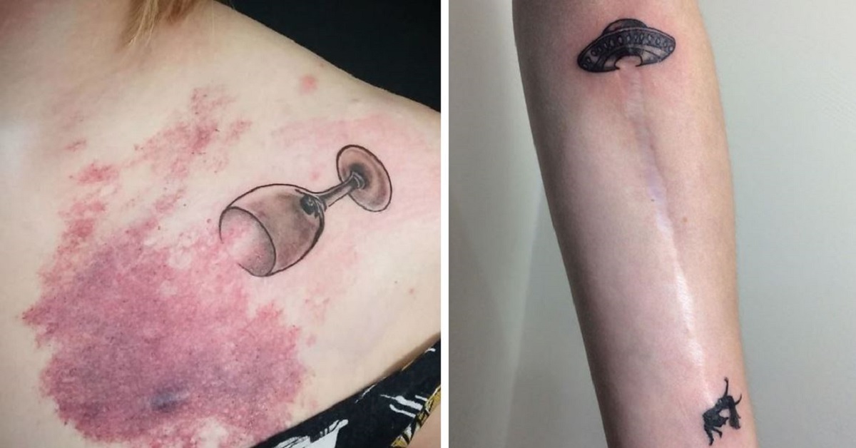 20 Amazing Tattoos Covering Scars And Birthmarks