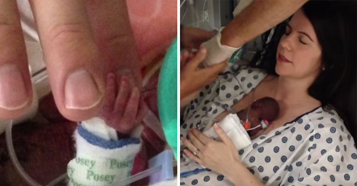 Outstanding Nursing Team Help Mom To Hold Her 12 Ounce Baby For The First Time